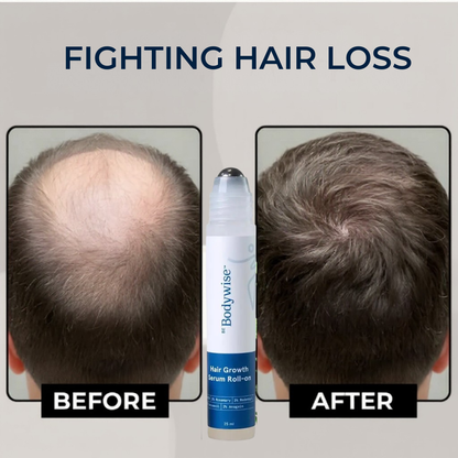 Hair Growth Roll-on Serum